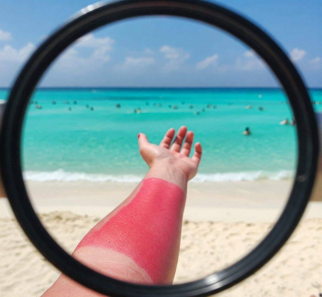 Cancun beach with a sunburned arm and a smudged len